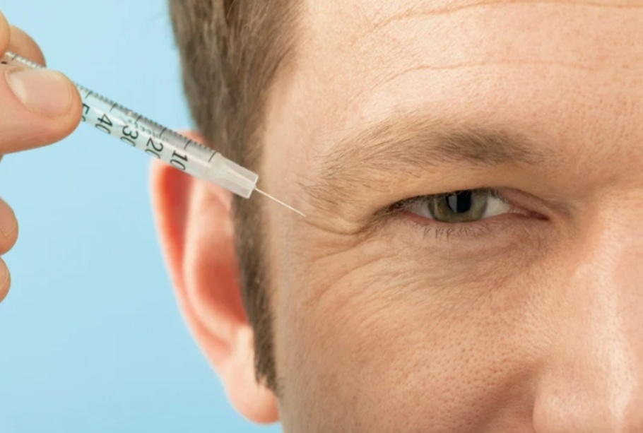 How Long Does Botox Last? What First-Time Patients Can Expect